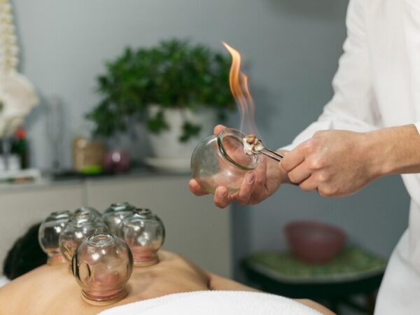 What are the Benefits of Doing Cupping Therapy